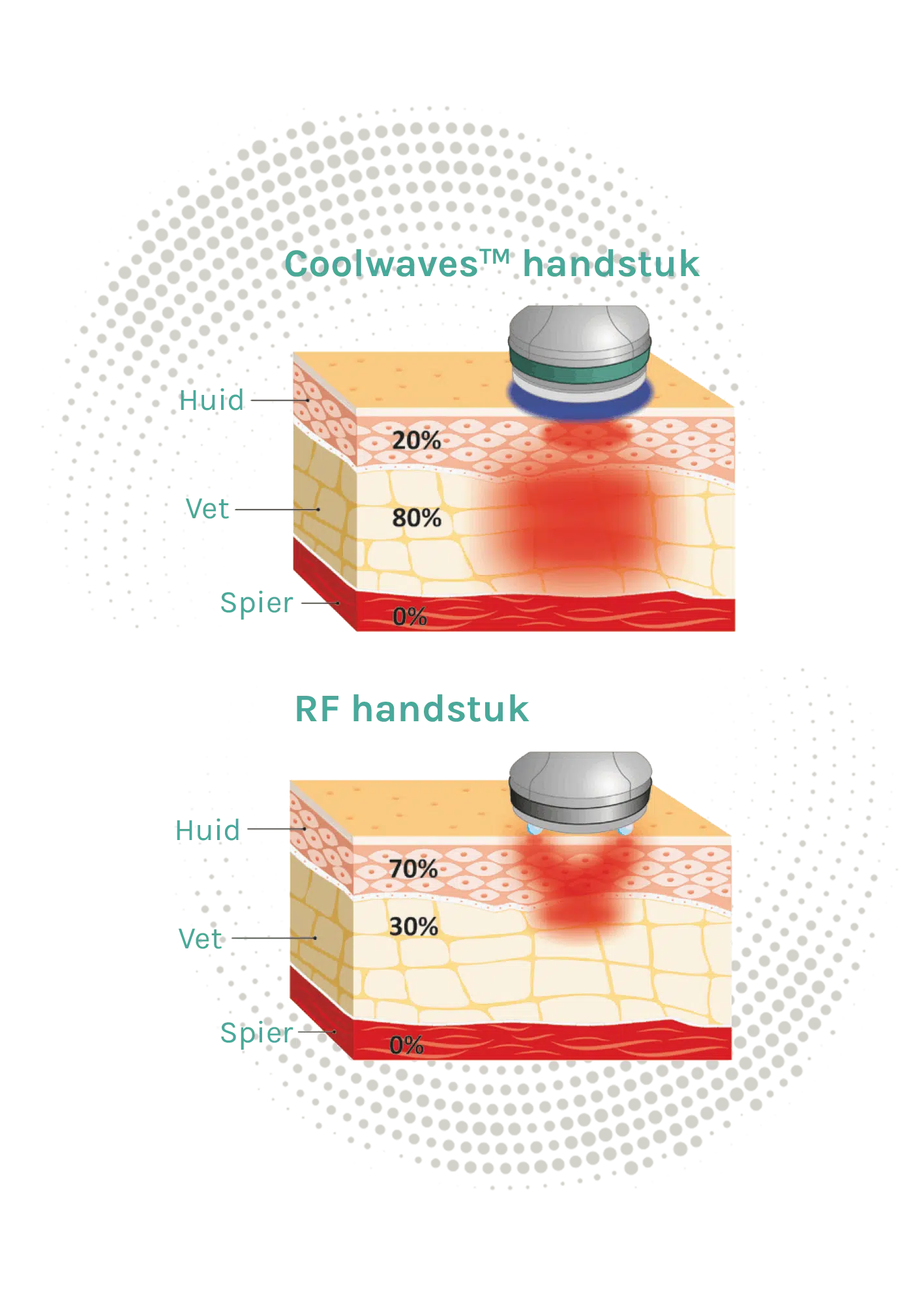 Onda Coolwaves bodyshaping Onda Coolwaves bodyshaping